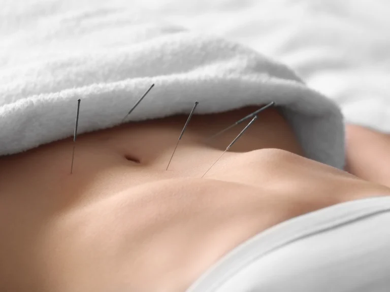 Naturopathy and Acupuncture During IVF Treatment